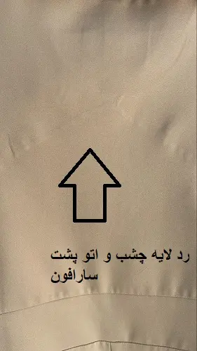 3448-کت و سارافون توتیا ( ایراد دار)