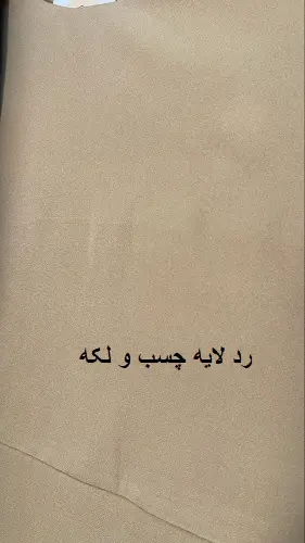 3448-کت و سارافون توتیا ( ایراد دار)